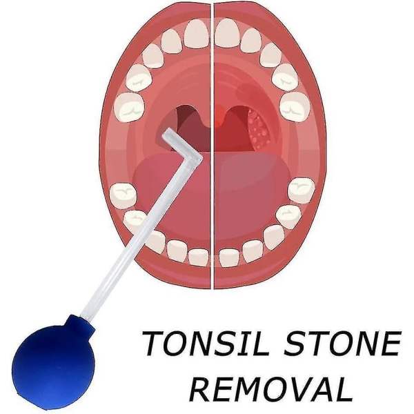 Tonsil Stone Remover Vakuum, Tonsil Stone Removal Kit Verktyg Tonsil Stone Treatment Oralt sugverktyg, tandsug Munrengöring Munrengöring Oral