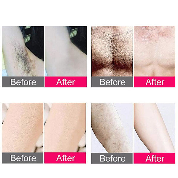 Ipl Hårfjerning Laser Epilator 300000 Flash Barbering og Hårfjerning Permanent Epilator for kvinner Smertefri WHITE