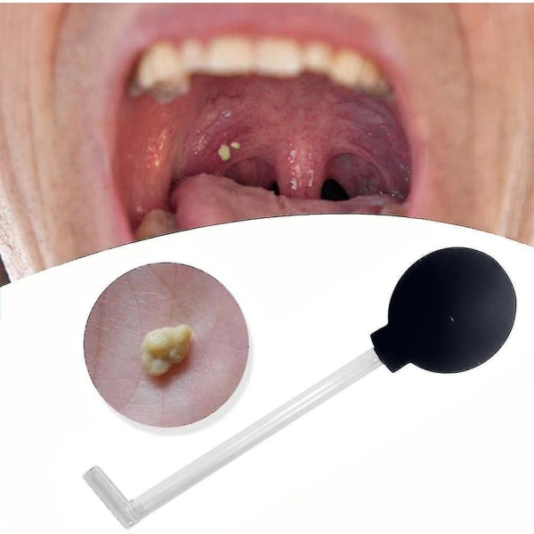 Tonsillakivenpoistoaine tyhjiö, nielurisojen kivenpoistosarja työkalu nielurisakivien hoitoon suun imutyökalu, hampaiden imu suupuhdistusaine suun puhdistusaine