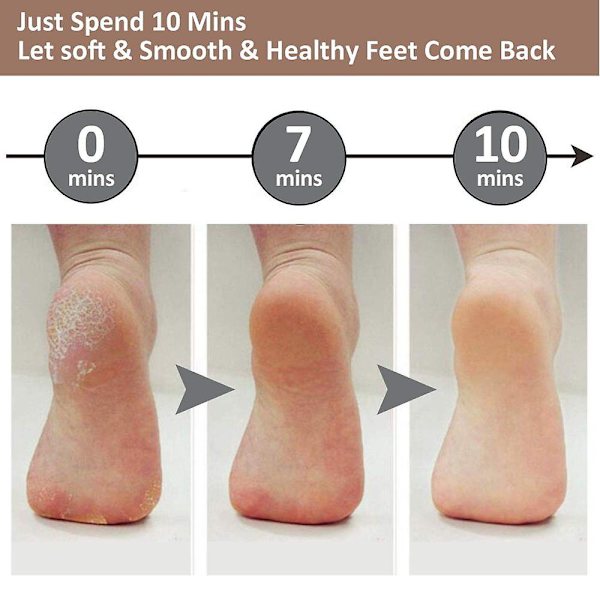 Pedicure Foot File Callus Remover - stor fodrasp Kolossal fodskrubber Professionel rustfrit stål callusfil til våde og tørre fødder