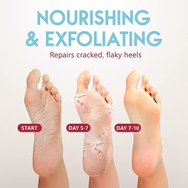 Summer Foot Premium Callus Socks - Callus Mask - Soft Feet Mask