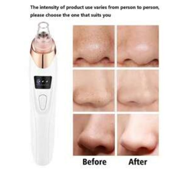Blackhead Remover USB Charging