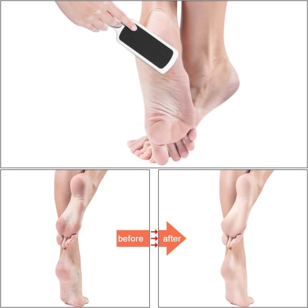 3 delar dubbelsidig fotfil Fotskrapa Fil Dead Skin Remover Fotskrubber Hard Skin Remover Fotvård för våta och torra spruckna fötter (Vit)