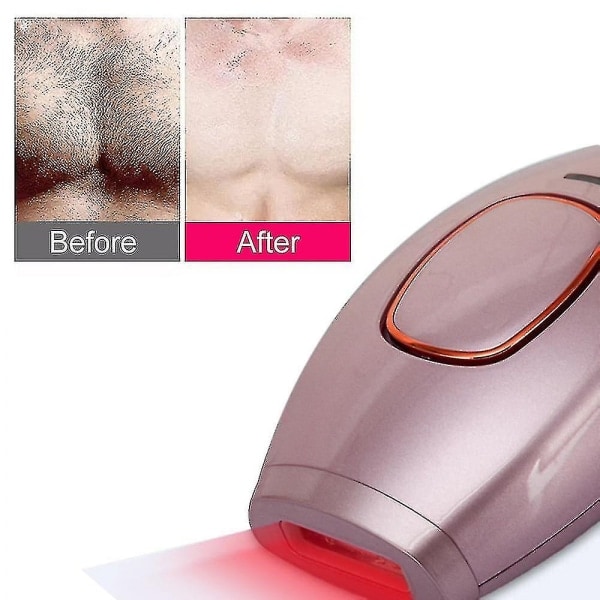 Laser Hårfjerning Hårfjerningsapparat 300.000 Blink Barbering Og Hårfjerning, Permanent Hårfjerningsapparat Kvinde