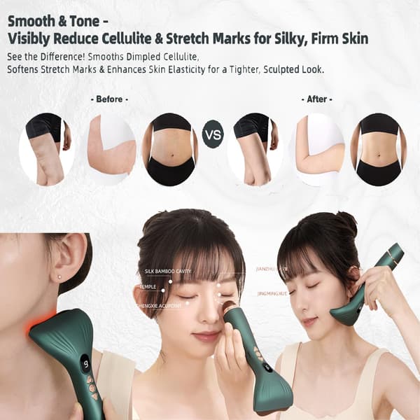 Lymfedrænage Massager – Gua Sha Bian Sten Massageværktøj Mod Cellulite Med 9 Varme- Og Vibrationsniveauer Til Helkropsskulptering hvid