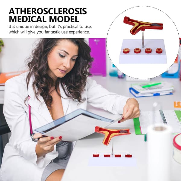 Aterosklerose Medicinsk Model Blodkar Anatomisk Model Kardiovaskulær Model