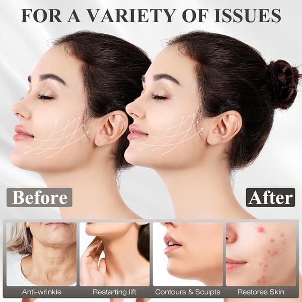 Justerbar søvn-hagerem, justerbar hagestøtte, ansigtskonturløftende maske, sort