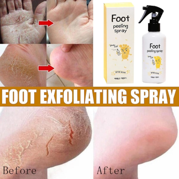 Eelhoe Foot Exfoliator Repair & Brightening Spray Callus Remover Foot Rejuvenator Foot Treatment 200ml