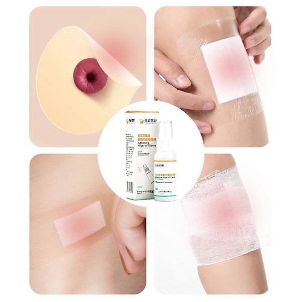 30 ml (A) Stomibase-klebefjerningsspray for å fjerne hudklebende strippespray Stomiposepleie