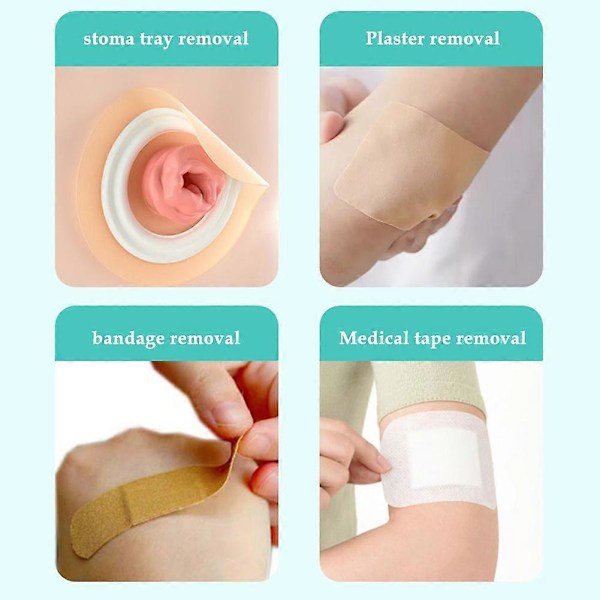 30 ml (A) Stoma-pohjaliiman poistosuihke ihon liiman poistoon, Stoma-pussin hoito