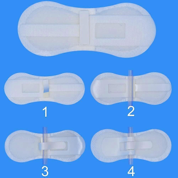 Sondeernæringspuder til Peg/G/J-sonde Mave Stabilisator Tilbehør Abdominal