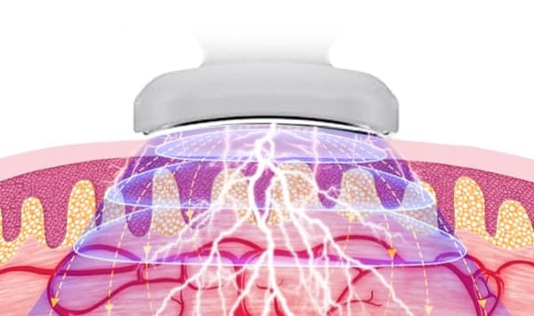 Nackmassör - Electric Pulse Neck Massager