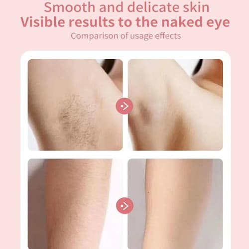 ICB Bikini Trimmer för kvinnor, Version C – IPX7 vattentät intimtrimmer med LCD-display, USB-uppladdningsbar, rosa