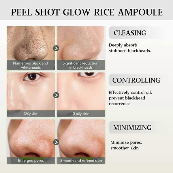Peel Shot Glow Risampulle Duo Hvit Ris+Svart Ris Ampulle, Eksfolierende Ansiktsskrubb & Kroppsskrubb Døde Hudceller, Ansiktsskrubb Eksfoliator Poreminimerende 3sets