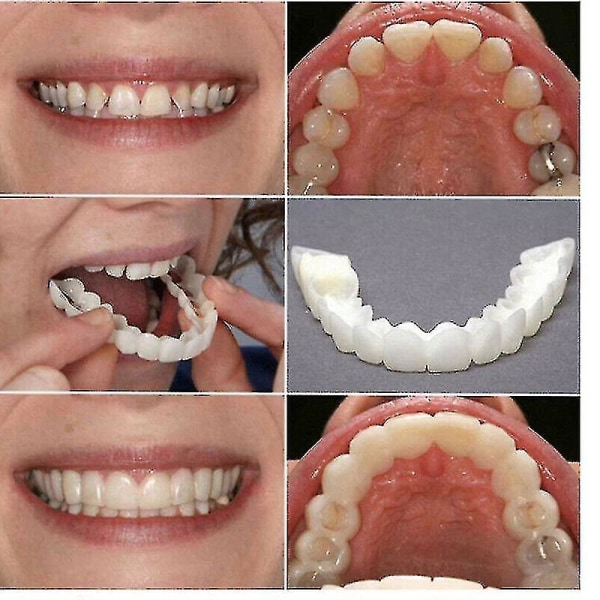 Snap On Teeth Övre + Nedre tandfasader Cover A Upper Lower teeth