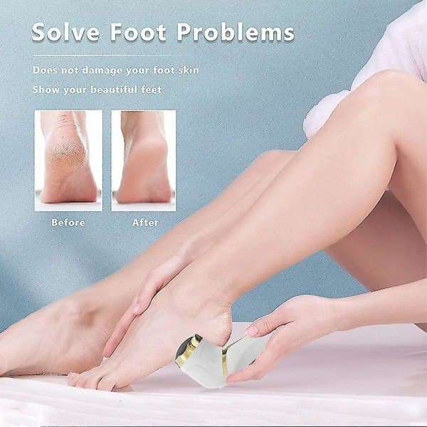 [13]Electric foot file, foot file for removing calluses