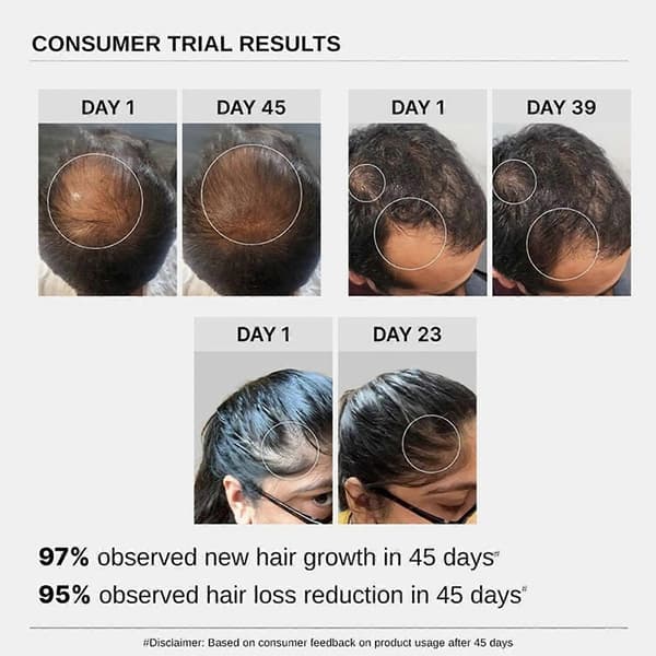 Bare Anatomy Advanced Hair Growth Serum - 30ml