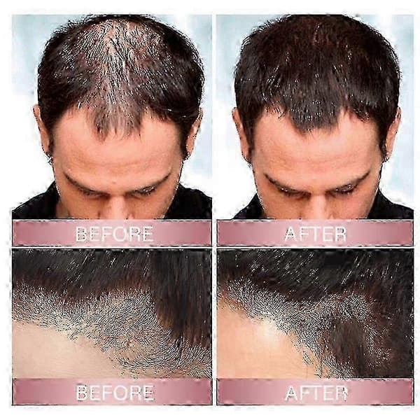 3 stk. Zephta H-Regrow 2.0, Zephta Hårgenvækst, Prorevita Ris Nutri Spray, til hår