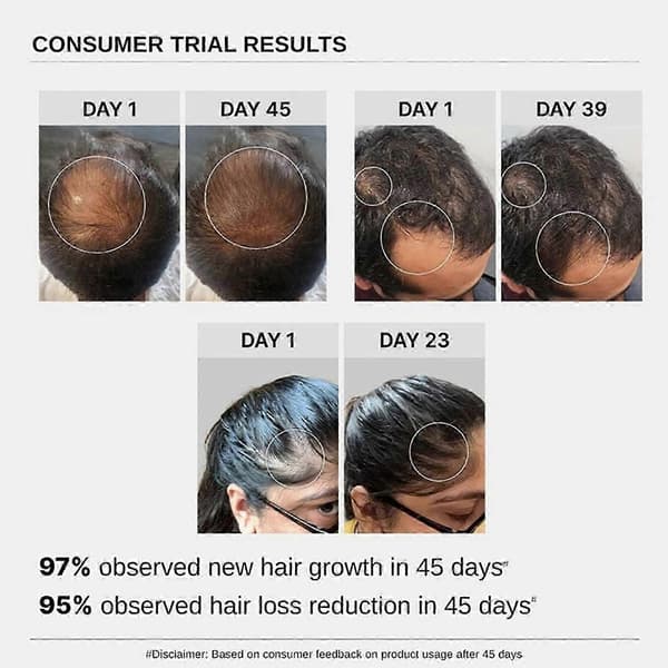 Bare Anatomy Advanced Hair Growth Serum - 30ml