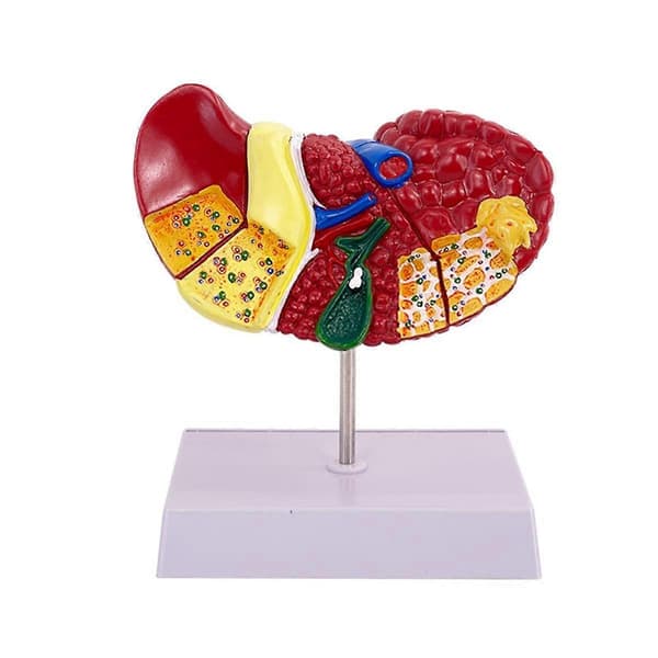 Liver Model for Common Pathologies, Liver Model Human Anatomy Doctor's Office Anatomy Model