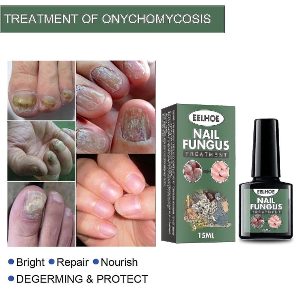 Eelhoe Nail Onycho Flydende Hånd- og Fodnegle Onychomy Care Reparation Nail Onyc Bx