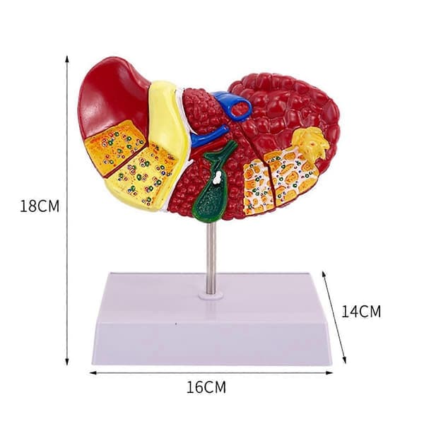 Liver Model for Common Pathologies, Liver Model Human Anatomy Doctor's Office Anatomy Model