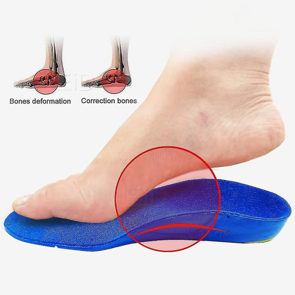 Barn Barn Ortotics Innersåler For Flat Feet Buestøtte Korreksjon Fotpleie For Kid Ortopedisk innersåle Sko Innlegg EU23-26 16.5cm