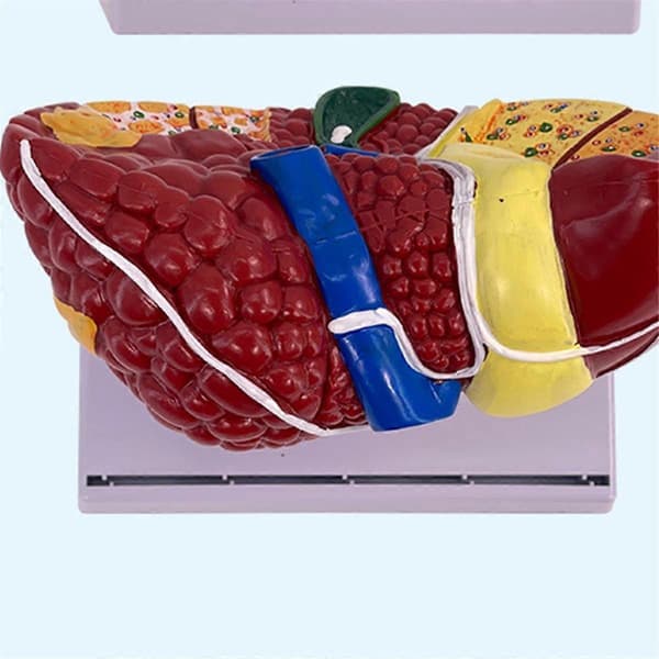 Liver Model for Common Pathologies, Liver Model Human Anatomy Doctor's Office Anatomy Model