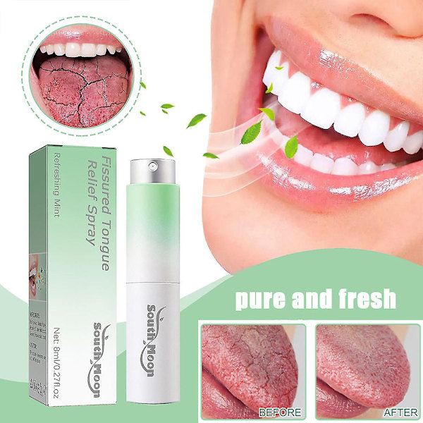 Fissurerad Tungspray - Snabb Lindring av Sprucken Tung & Fräsch Andedräkt 2pcs