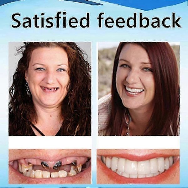 instantsmile Silikon Reline Tandprotesuppsättning, Avancerad Tandprotes Reliner Kit, Omedelbar Komfortpassform För Övre Och Nedre Tandproteser