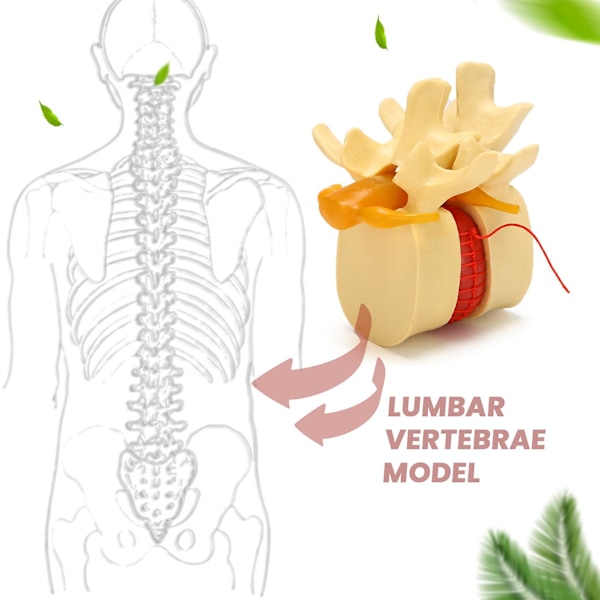 Ländryggskota Modell Anatomisk Ryggrad Ländryggsdiskbråck Anatomi Undervisningsverktyg Ländryggskota