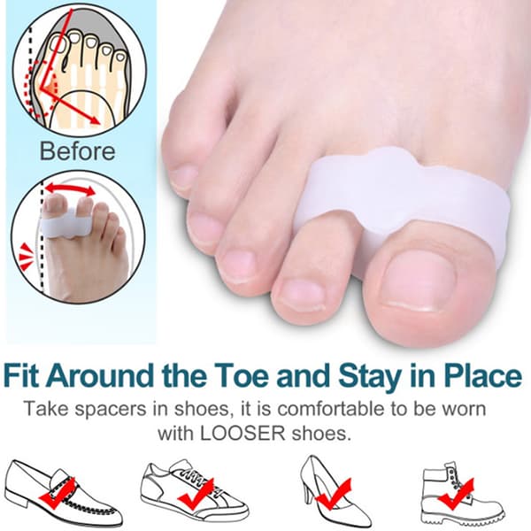 2kpl silikoninen jalkasormivarvaserotin Hallux Valgus Corrector 3.5*1.4cm