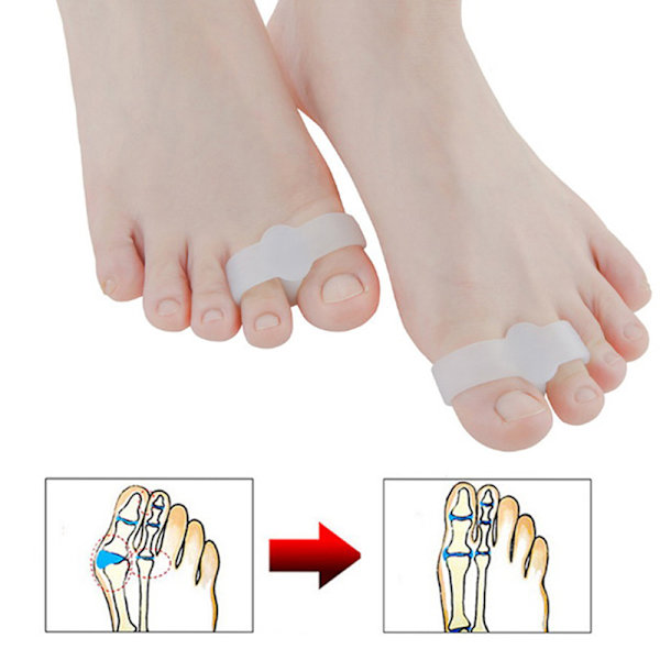 2 STK Silikone Fod Finger Tå Separator Hallux Valgus Corrector 3.5*1.4cm