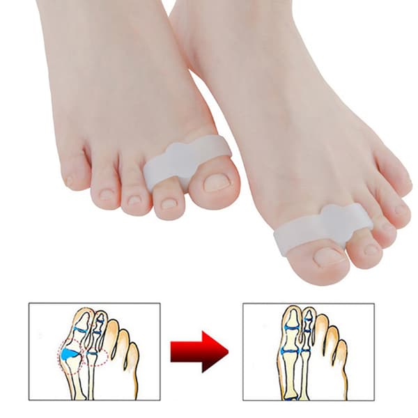 2kpl silikoninen jalkasormivarvaserotin Hallux Valgus Corrector 3.5*1.4cm