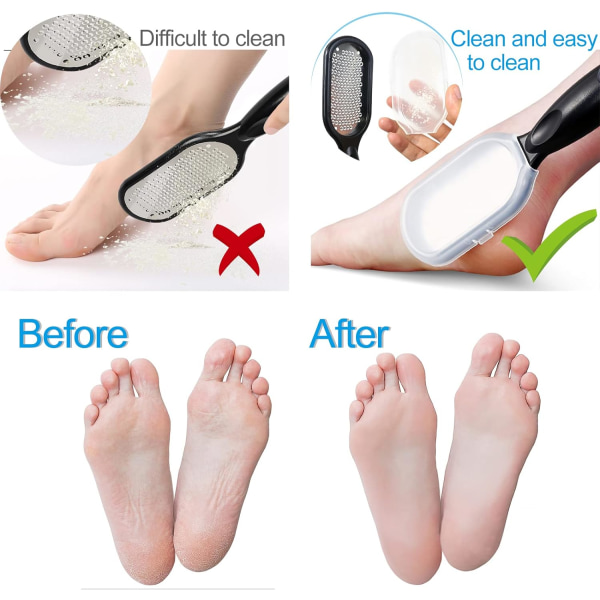 Fodfil, fodskraber, bedste fodpleje pedicure Metaloverfladeværktøj til fjernelse af hård hud Kan bruges på både våde og tørre fødder
