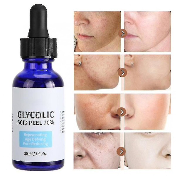 Glykolsyra Peel Renhet 70% Koncentration 5% Hudreparation Osynliga porer Ljus upp hudton Behandling