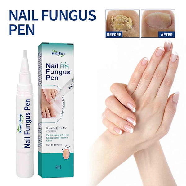 Nail Repair Pens And Toenail Repair Pens For Improving Infected Toenails, Nails, And Toenails3ml