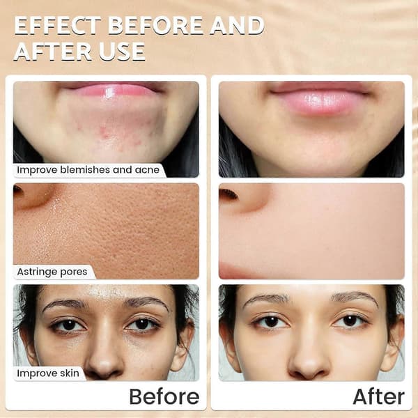 7% Glycolic Acid Exfoliating Toner with Deep Hydration and Pore-Minimizing Effect, 100ml