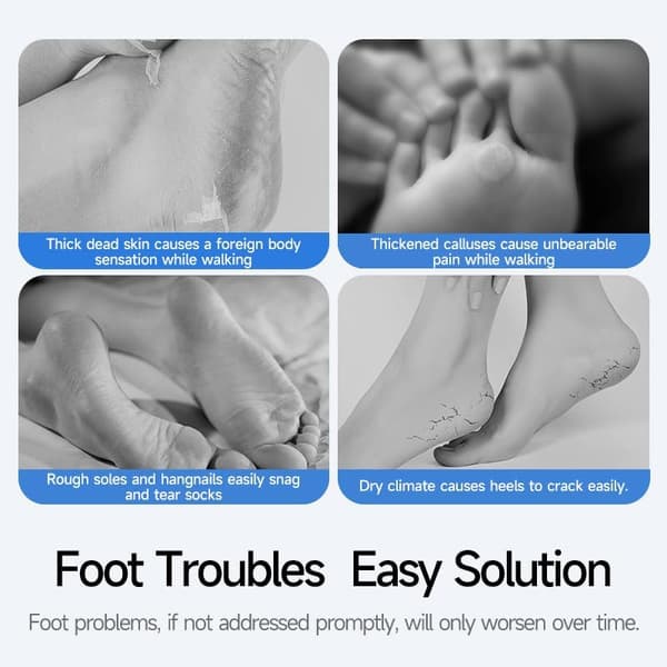 Electric Foot File, Smoothing Pedicure Tool