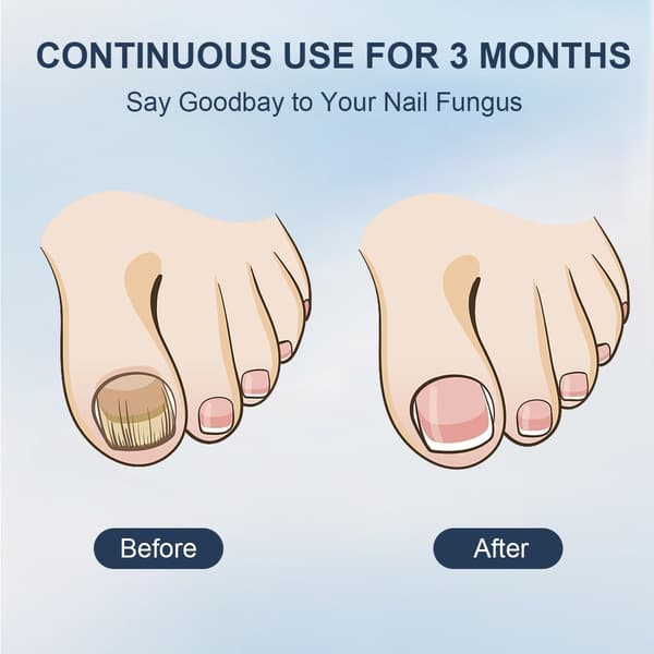 Portable multifunctional nail lamp for toenails and fingernails