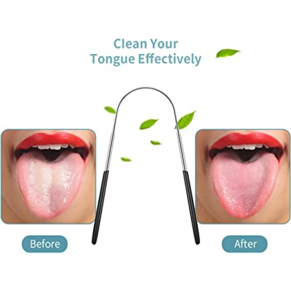 4 stykker tungeskrapere, reduserer dårlig ånde Tungerens Sta