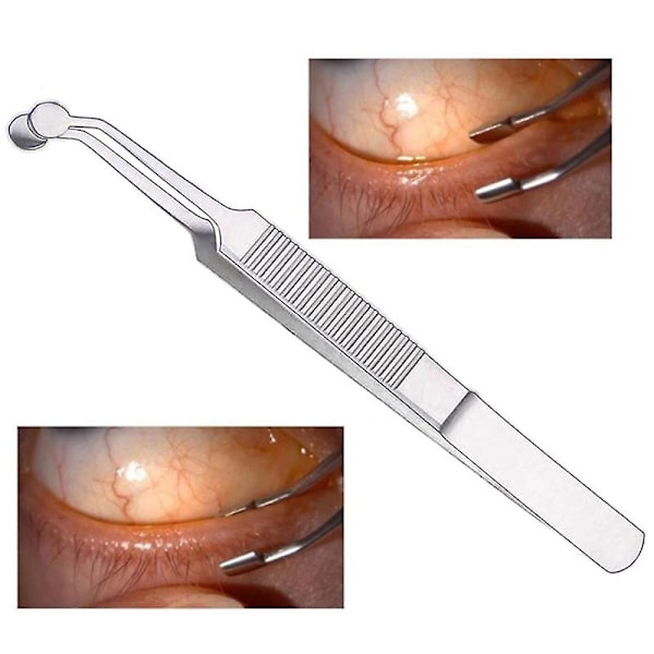 Meibomius Gland Massage Pinces Ophtalmologique Graisse Œil Physio