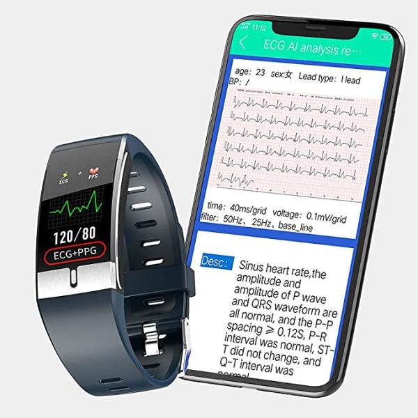 EKG smart watch (röd), IP68 vattentät fitness , med tem