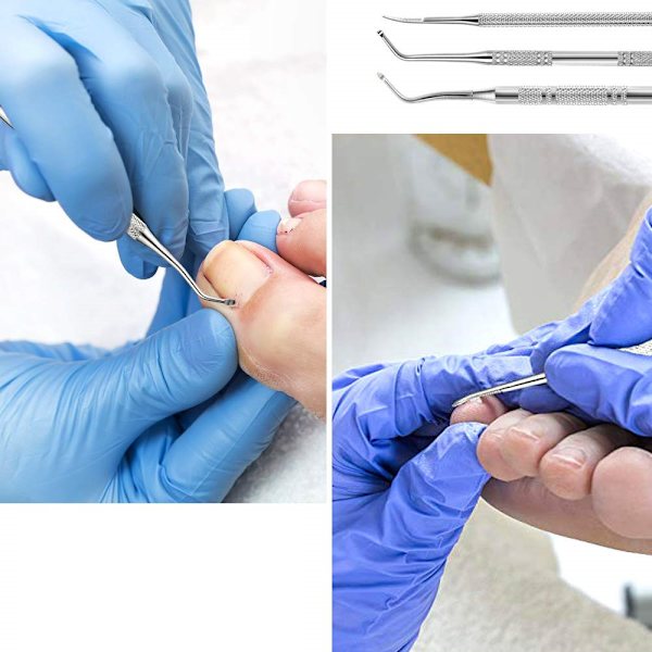 3-delad nagelgrävare-set - Dubbelsidig grävare - Nagelbäddsröjare