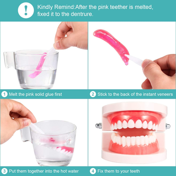 6 Instant Veneer Dentures Bekväma Övre Leende Tänder Vita Kosmetiska Tänder Tillfälliga Falska Tänder Flexibla Tänder Filler Kit för att täcka saknade tänder