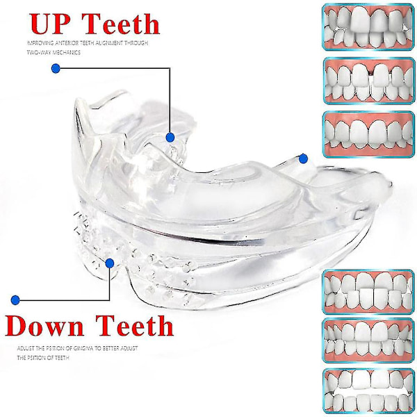 3 st/set Dental Tand Ortodontisk Apparat Tränare Tandställning Tänder Tränare För Vuxna Ortodontisk Tandställning {xpreenofficialstore}