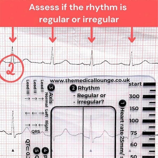 EKG 7-stegs Linjal EKG Linjal Plastlinjal Mätverktyg för EKG/EKG Tolkning Lätt att Bära med 1 Skyddsfodral