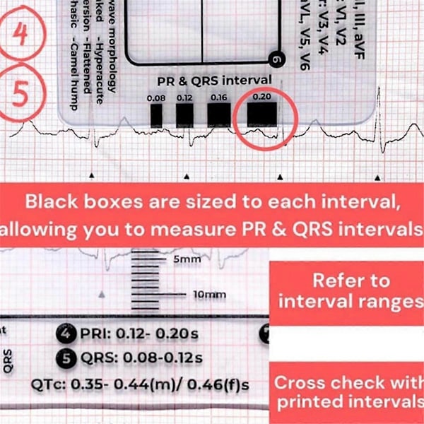EKG 7-stegs Linjal EKG Linjal Plastlinjal Mätverktyg för EKG/EKG Tolkning Lätt att Bära med 1 Skyddsfodral