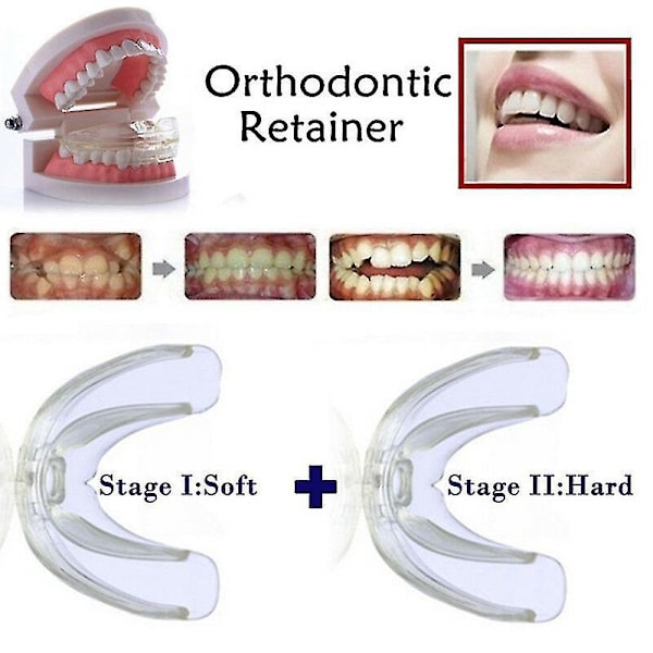 3 st/set Dental Tand Ortodontisk Apparat Tränare Tandställning Tänder Tränare För Vuxna Ortodontisk Tandställning {xpreenofficialstore}