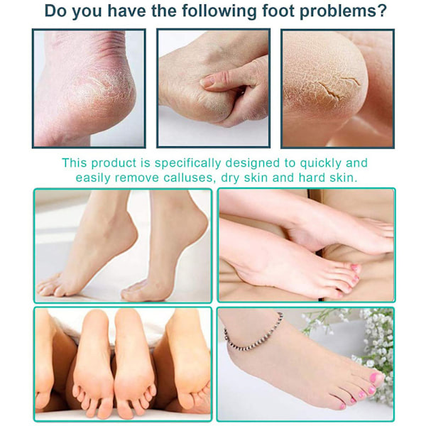Professionelt Pedicure Sæt, Eksfoliering Hård hud Fodfil Sæt